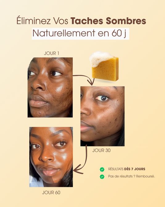 Savon Anti-taches au Curcuma